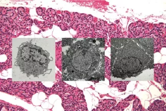 Mapping the human parathyroid gland