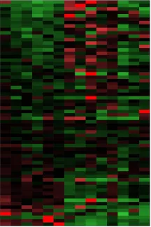 A heat map of gene expression levels helps visualize patterns shared by tumors compared to normal tissues.