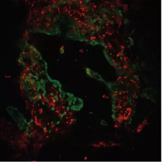 Multiple different cell types in the parathyroid gland work together to monitor and regulate blood calcium levels.  Identifying and profiling these cell types at the molecular level is essential for understanding how to reconstitute normal calcium homeostasis in patients who have lost parathyroid gland function.