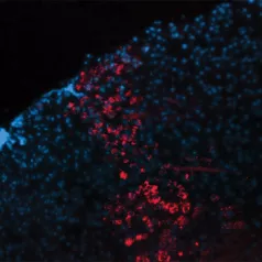 Near-infrared imaging of adrenal tumors